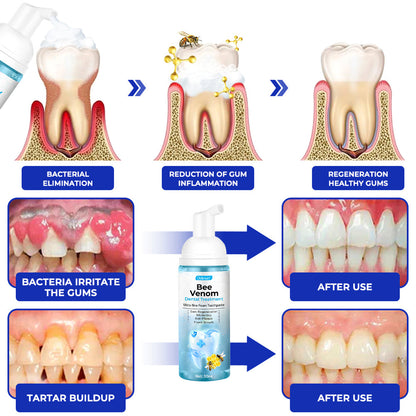 ODEIUN™ MicroSmile Bee Venom Ultra-Fine Foam Toothpaste + Tongue Scraper