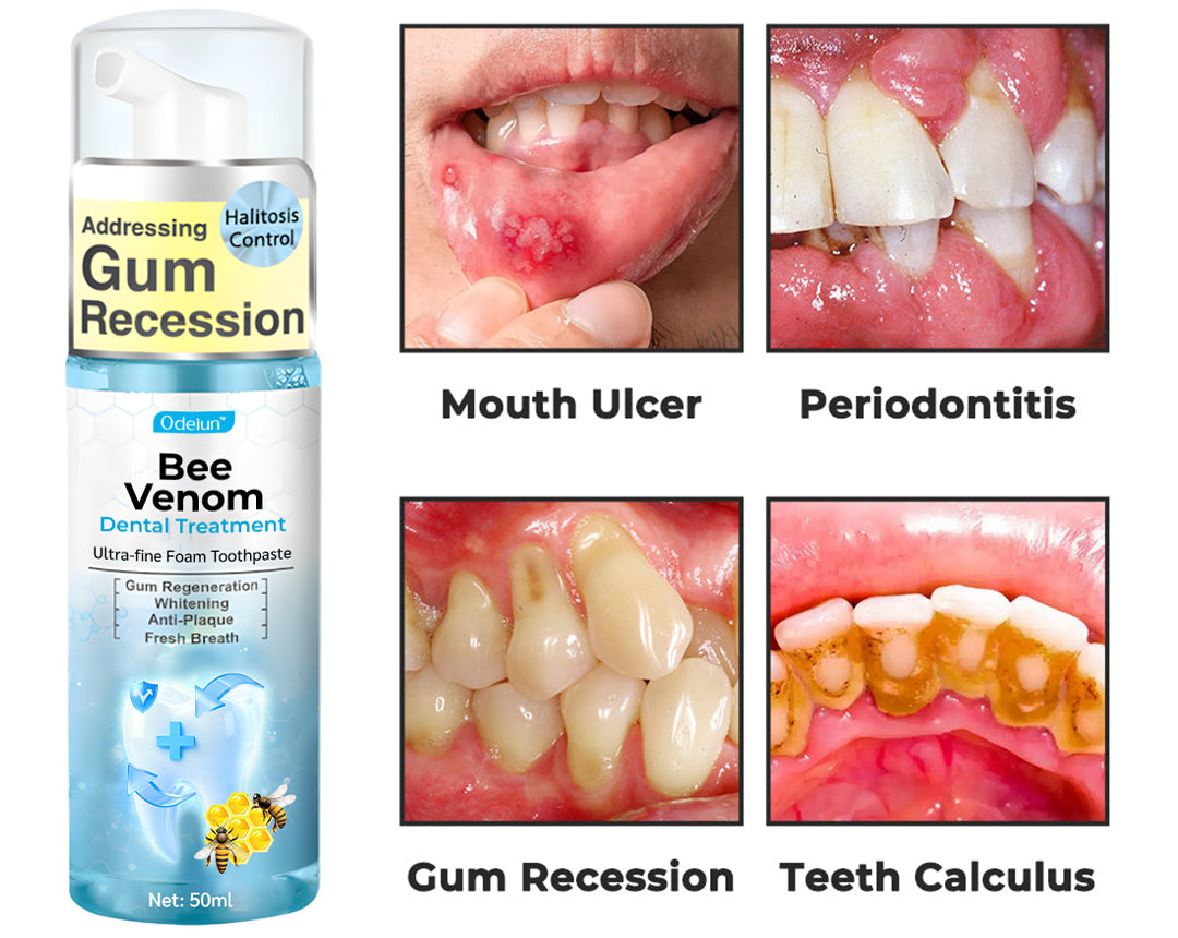 ODEIUN™ MicroSmile Bee Venom Ultra-Fine Foam Toothpaste + Tongue Scraper