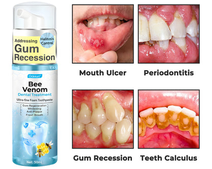 ODEIUN™ MicroSmile Bee Venom Ultra-Fine Foam Toothpaste + Tongue Scraper