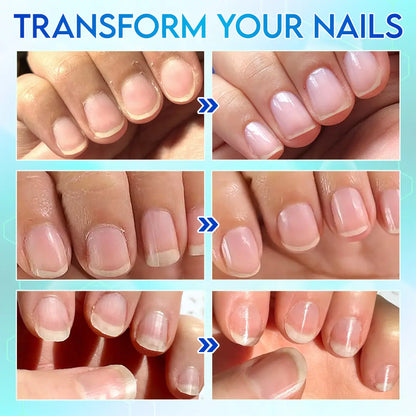 AuraTrim Care™ 360 Automatic Nail Trimmer