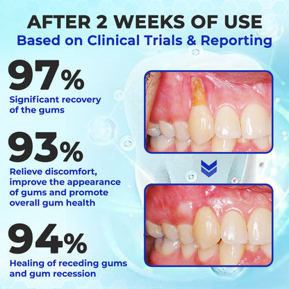 ODEIUN™ MicroSmile Bee Venom Ultra-Fine Foam Toothpaste + Tongue Scraper