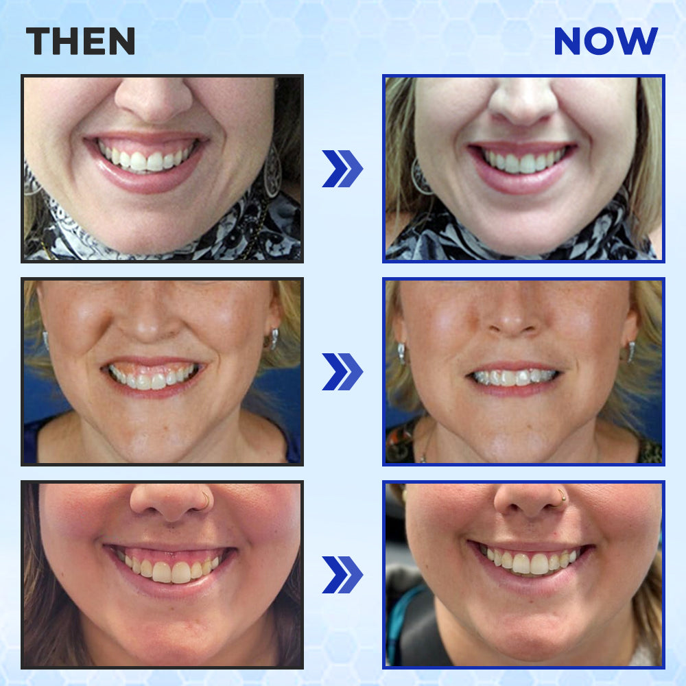 ODEIUN™ MicroSmile Bee Venom Ultra-Fine Foam Toothpaste + Tongue Scraper