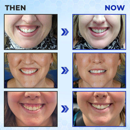 ODEIUN™ MicroSmile Bee Venom Ultra-Fine Foam Toothpaste + Tongue Scraper