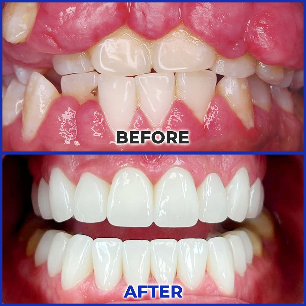 ODEIUN™ MicroSmile Bee Venom Ultra-Fine Foam Toothpaste + Tongue Scraper