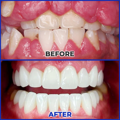 ODEIUN™ MicroSmile Bee Venom Ultra-Fine Foam Toothpaste + Tongue Scraper