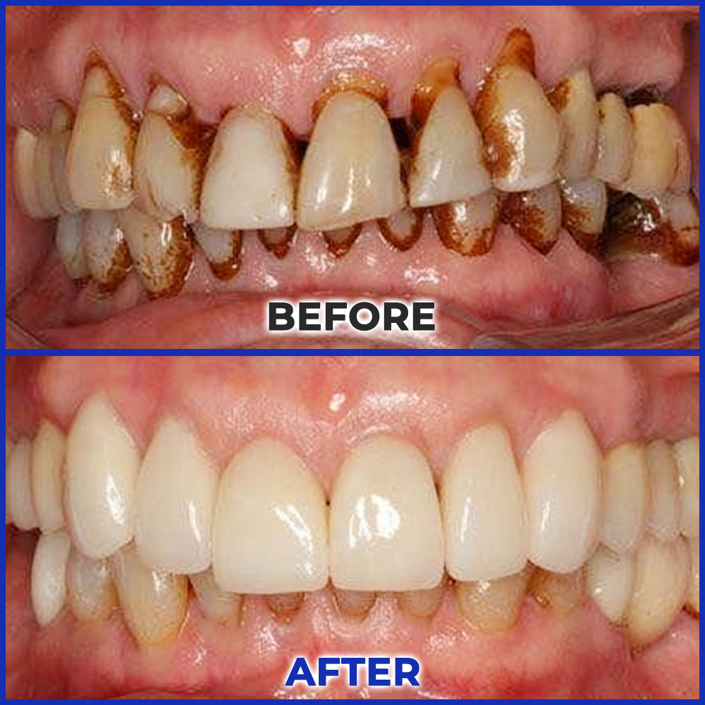 ODEIUN™ MicroSmile Bee Venom Ultra-Fine Foam Toothpaste + Tongue Scraper